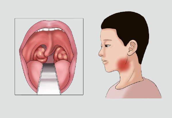 肉粽子需求煮多久？